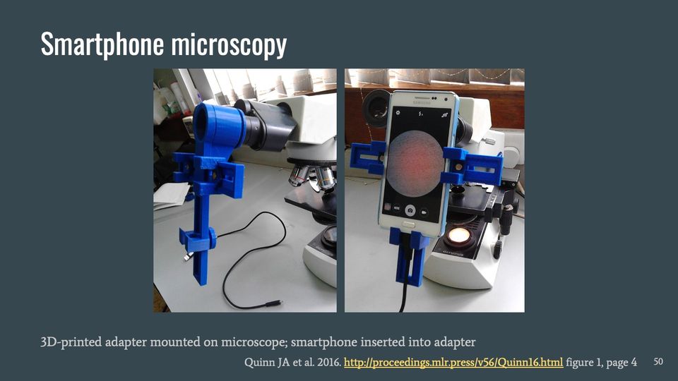 Two photos of a microscope fitted with a blue 3D-printed adapter; in the second, a smartphone sits in the adapter over the eyepiece.