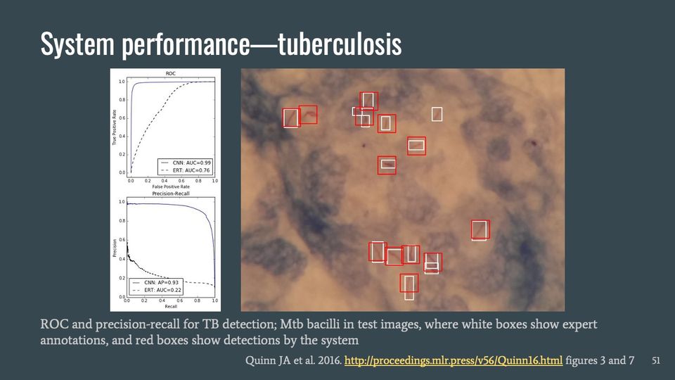 Two stacked performance curves (ROC and precision-recall) beside a micrograph with red and white boxes marking thin rod shapes.