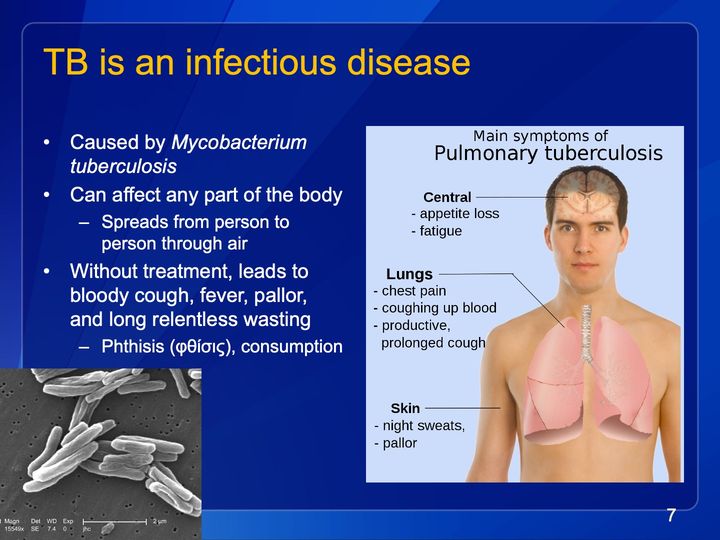 photographic figure of a man's head and bare torso with the brain and the lungs and windpipe drawn over it; 3 bold headings, each with a short list, joined by leader lines to a body region