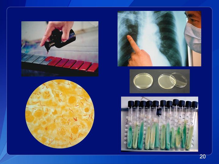 Five lab photos: red stain dripped on slides, a masked person at a chest X-ray, 2 culture dishes, red rods under a microscope, green culture tubes.